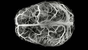 Descubren una enfermedad ultrarrara con solo 13 casos en el mundo