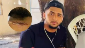 Desaprensivos colocan alambre para asaltar y joven sufre grave herida en el cuello