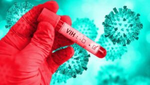 Registran más de 55,000 pacientes con carga viral de VIH durante un año