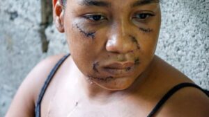 Sobrevivir a 26 puñaladas: las heridas que cura Nayely